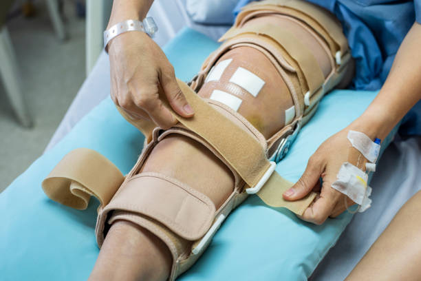 Recovery Tips After Knee Replacement Surgery